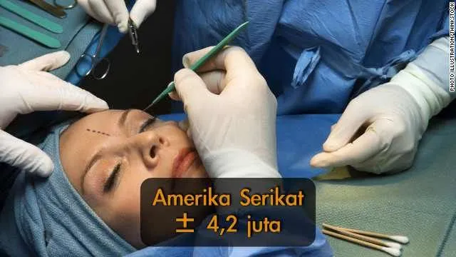 5 Negara yang Paling Banyak Lakukan Operasi Plastik. Korea Selatan Malah Nggak Masuk 5 Besar! 6