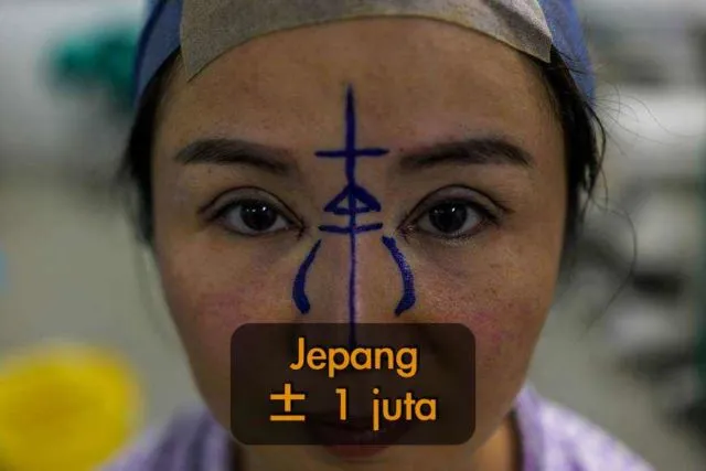 5 Negara yang Paling Banyak Lakukan Operasi Plastik. Korea Selatan Malah Nggak Masuk 5 Besar! 8