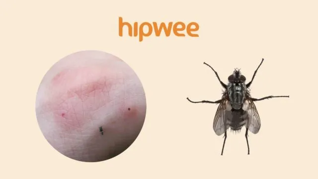 11 Tipe Bekas Gigitan Serangga yang Ada di Sekitar Kita. Biar Lebih Waspada akan Bahayanya 22