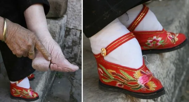 Antara Foot Binding dan High Heels, Perempuan Masih Saja Menyiksa Kakinya Demi Merasa Cantik 10