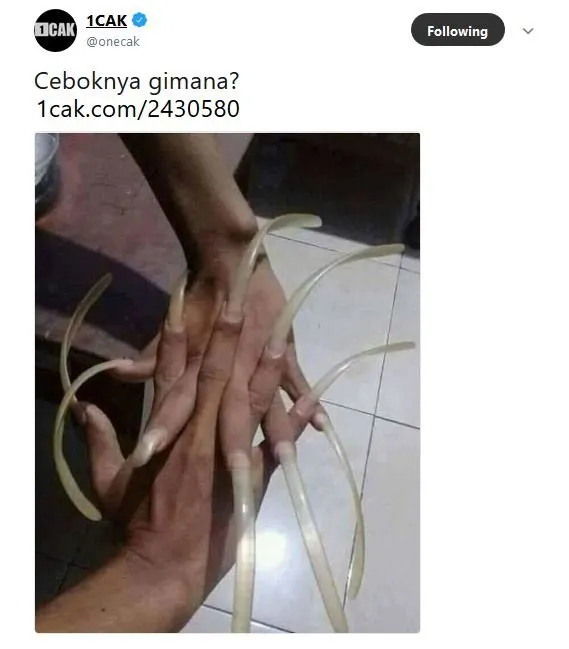 Lihat Kuku Begini, Warganet Jadi Penasaran sama Satu Hal. Tapi Jawabannya Lebih Nggak Masuk Akal sih 12