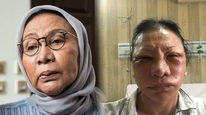5 Alasan Kenapa Kita Nggak Boleh Sebaper Itu Soal Politik. Yuk Sambut Tahun Politik dengan Damai 6
