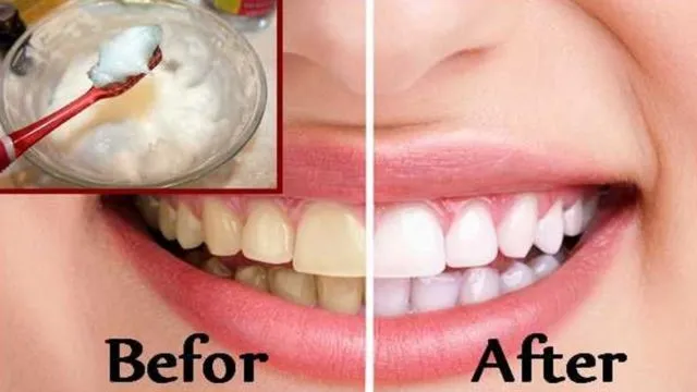 8 Langkah Agar Gigi Putih, Bersih, dan Sehat. Siap-siap Senyum Menawan 13 tips gigi sehat