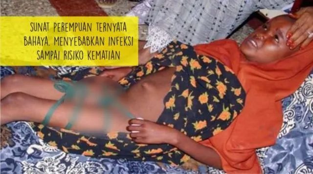 Sunat Perempuan Masih Dilakukan di Beberapa Negara, Termasuk Indonesia. Inilah 9 Faktanya 16