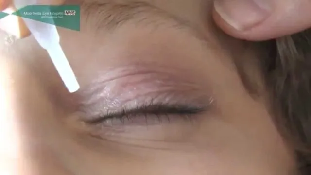 7 Cara Tepat Menggunakan Obat Tetes Mata, Jangan Sembarangan! 12