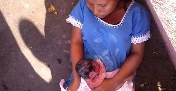 9+ Potret Penderitaan Wanita Hamil di Venezuela. Banyak yang Sampai Harus Melahirkan di Jalanan Lo! 17