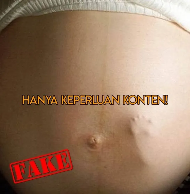 10 Penjelasan di Balik Foto Fenomenal yang Masih Sering Dikira Nyata. Banyak yang Editan Doang Lo 15