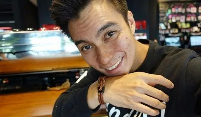10 Artis Ini Pernah Dibully Gara-Gara Jerawatan. Julidnya Warganet Emang Nggak Ketulungan! 13