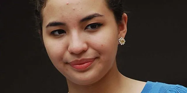 10 Artis Ini Pernah Dibully Gara-Gara Jerawatan. Julidnya Warganet Emang Nggak Ketulungan! 14