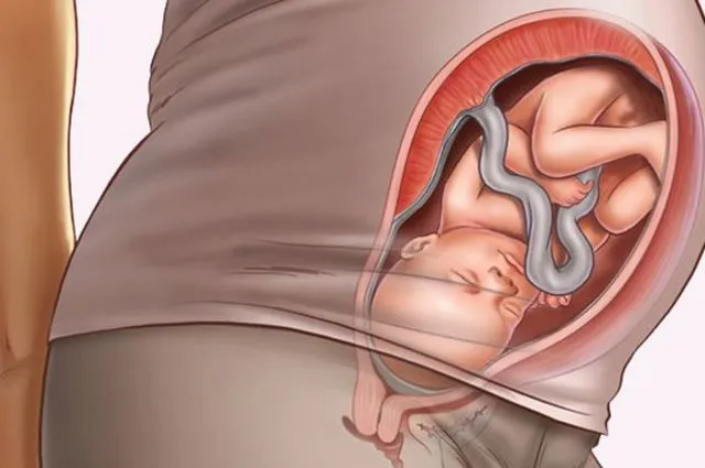 4 Manfaat Birthing Ball untuk Kehamilan & Persiapan Melahirkan. Jelas Bukan Gaya-gayaan Doang! 7