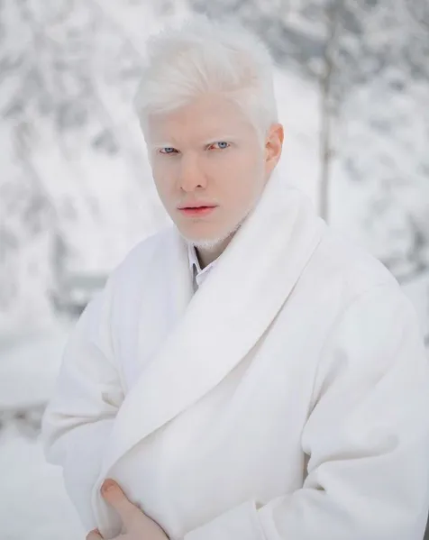 Kenalan Yuk Sama Bera, Cowok Albino yang Bikin Kamu Berdecak Kagum. Selain Doi, 5 Model Ini Tak Kalah Memesona 11