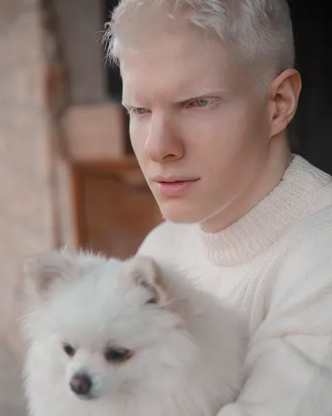 Kenalan Yuk Sama Bera, Cowok Albino yang Bikin Kamu Berdecak Kagum. Selain Doi, 5 Model Ini Tak Kalah Memesona 12