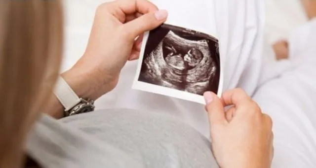 Sama-sama Bisa 'Mengintip' Wajah Janin di Perut, Inilah Bedanya USG 2D, 3D, 4D dan Trans Vaginal 7