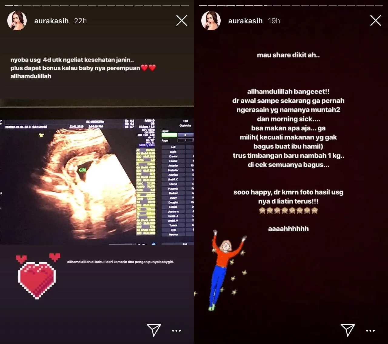 Bagikan Pengalaman Hamilnya Lewat Cara Ini, Aura Kasih Malah Dibilang 'Hamil Kebo' 4