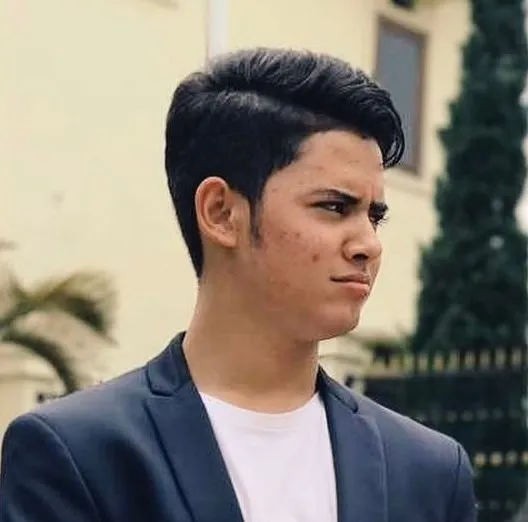 10 Artis Ini Pernah Dibully Gara-Gara Jerawatan. Julidnya Warganet Emang Nggak Ketulungan! 11