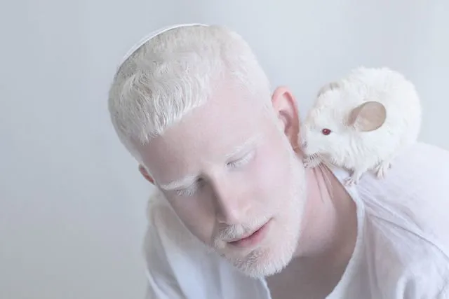 Kenalan Yuk Sama Bera, Cowok Albino yang Bikin Kamu Berdecak Kagum. Selain Doi, 5 Model Ini Tak Kalah Memesona 17