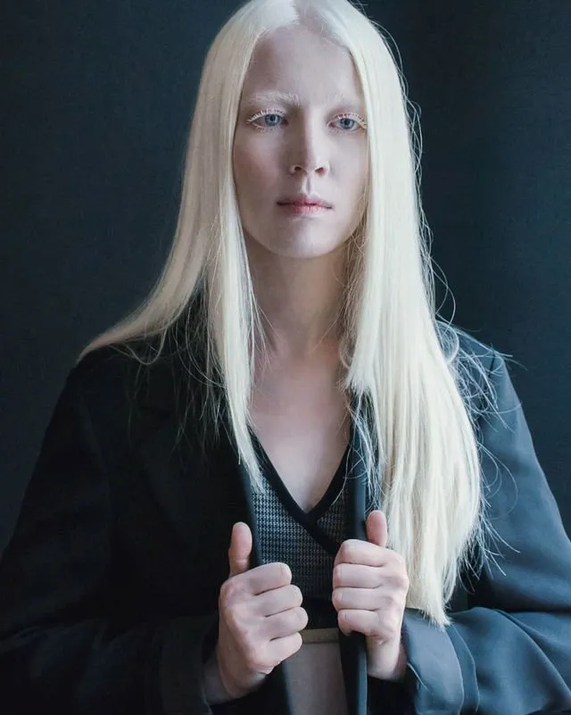 Kenalan Yuk Sama Bera, Cowok Albino yang Bikin Kamu Berdecak Kagum. Selain Doi, 5 Model Ini Tak Kalah Memesona 20