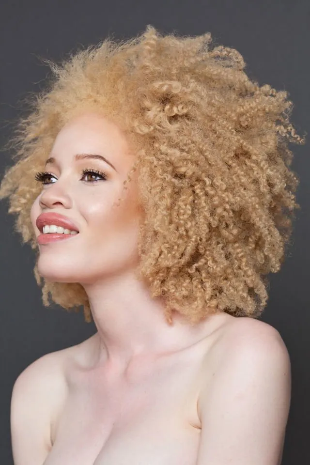 Kenalan Yuk Sama Bera, Cowok Albino yang Bikin Kamu Berdecak Kagum. Selain Doi, 5 Model Ini Tak Kalah Memesona 19