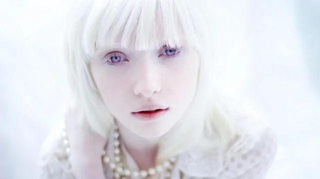 Kenalan Yuk Sama Bera, Cowok Albino yang Bikin Kamu Berdecak Kagum. Selain Doi, 5 Model Ini Tak Kalah Memesona 15