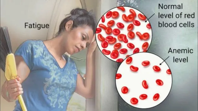5 Bahaya Minum Teh Setelah Makan. Segar Memang, tapi Bawa Kerugian 8