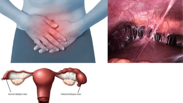 6 Kondisi Medis yang Menyebabkan Rahim Harus Diangkat. Tetap Hati-Hati, Ya! 12
