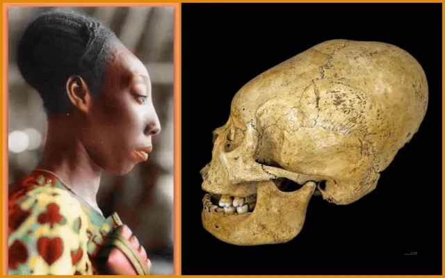 Satu Lagi Bukti Standar 'Cantik' yang Berbeda. Dulu, Kepala Panjang Mirip Alien Pernah Dipuja-puja 9