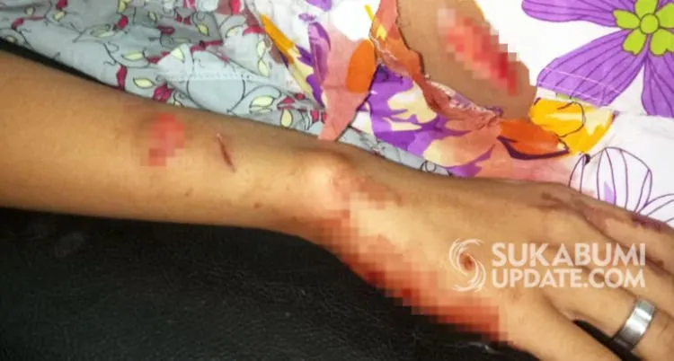 Siswa Dibacok Temannya Sendiri di Sukabumi. Mirisnya, Kejadian Ini Terjadi di Dalam Kelas Lo 6