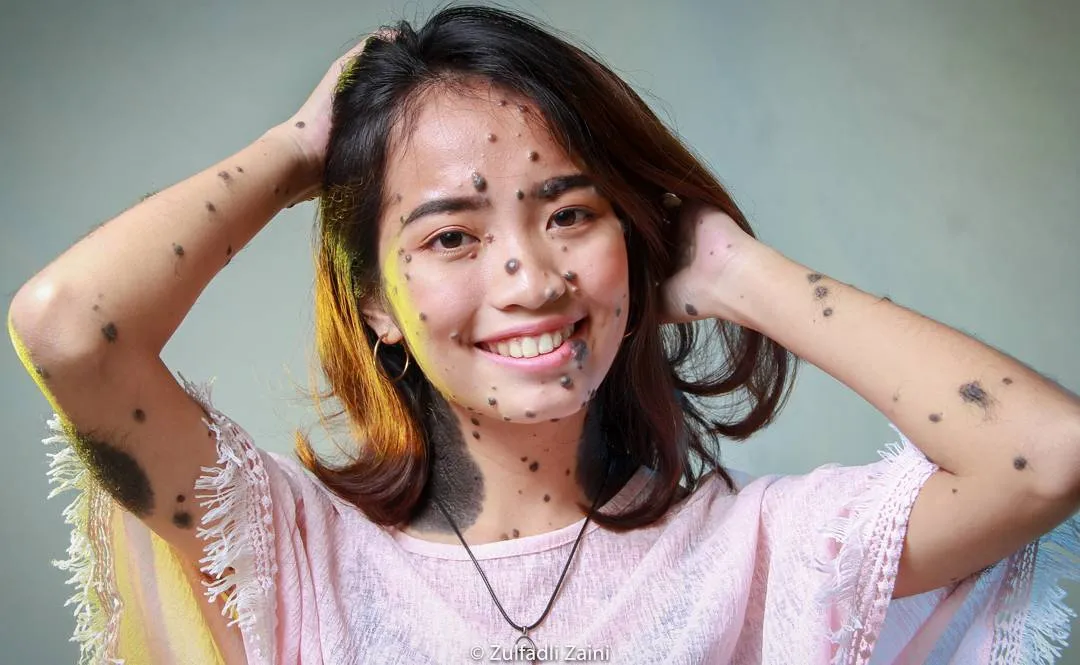 9 Orang Berpenampilan Unik ini Bikin Kita Sadar Bahwa Cantik dan Tampan Cuma Soal Persepsi, Nggak Mutlak! 10