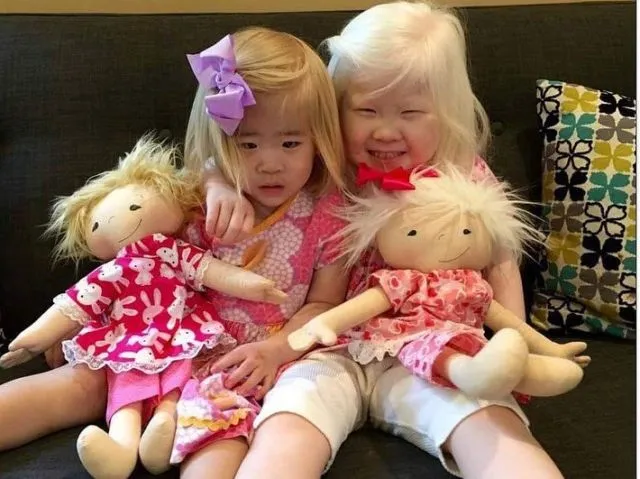 Bikin Terenyuh, 7+ Potret Anak 'Spesial' dan Boneka Berkarakter Mirip Mereka Ini Dibuat untuk Alasan yang Sangat Mulia 19