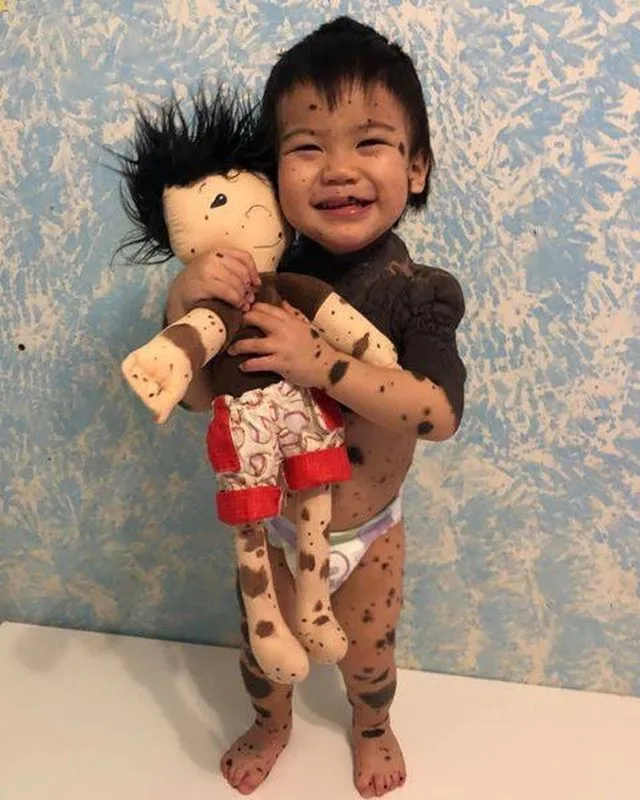 Bikin Terenyuh, 7+ Potret Anak 'Spesial' dan Boneka Berkarakter Mirip Mereka Ini Dibuat untuk Alasan yang Sangat Mulia 13