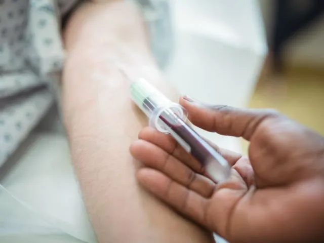 6 Info Tentang Kanker Darah yang Simpang Siur. Kanker Darah = Leukimia? 10 fakta kanker darah