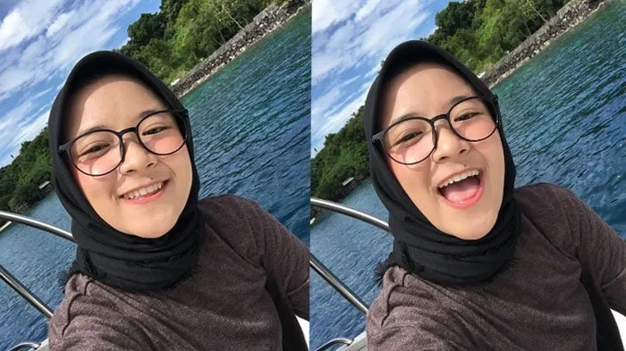 7 Posisi Tahi Lalat yang Bikin Orang Makin Manis Manja. Makanya Nggak Usah Minder deh~ 11