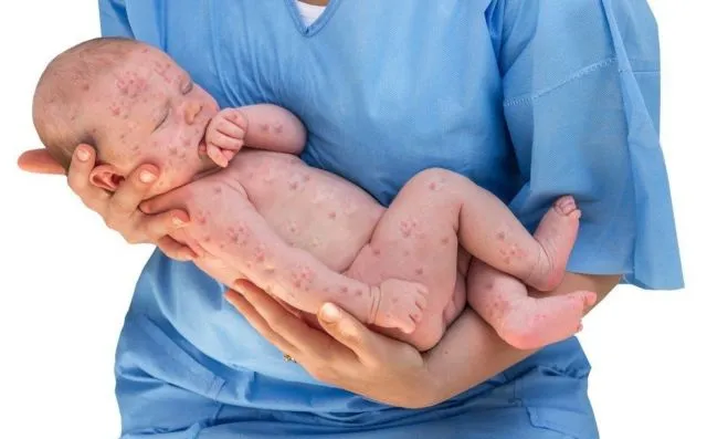 Italia Larang Anak Tanpa Vaksin Masuk Sekolah. Solusi Jitu untuk Orang Tua Bandel Nih 10