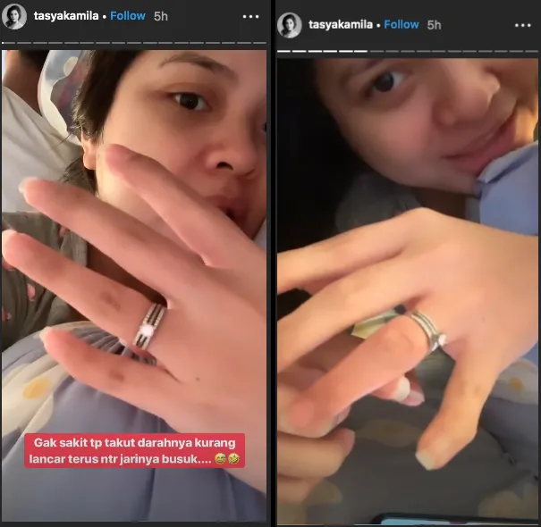 Cincin Nikah Susah Lepas, Tasya Kamila Takut Jarinya Busuk. Sang Suami Jadi Ikutan Panik 4