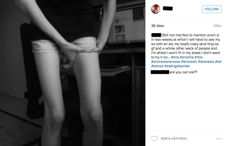 Kisah Mantan Pengidap Anoreksia, Makin Parah Karena Terobsesi Konten-Konten di Instagram. Ngeri! 4