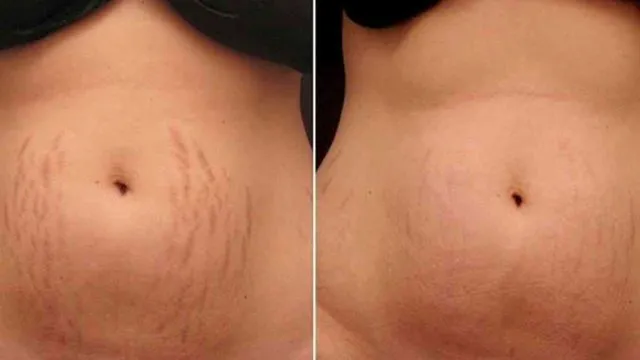 8 Manfaat Vitamin E untuk Wajah dan Kecantikan 14