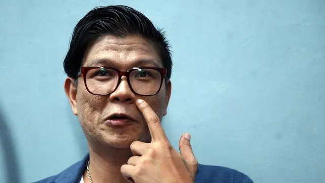 Selain Karena PD, Mungkin 7+ Motivasi ini Bikin Andika Babang Tamvan Tolak Oplas Gratis. Bebas dong! 13