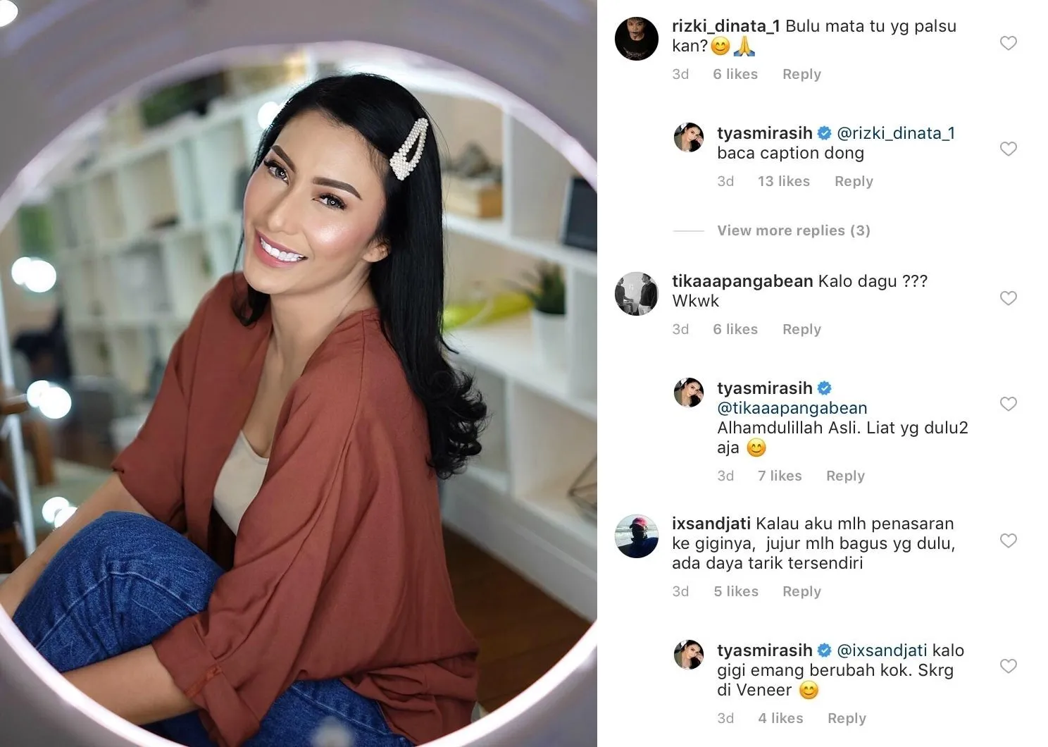 Jengah Dibilang Oplas, Tyas Mirasih Buktikan Kalau Hidung Mancungnya Asli. Cuma Satu Kok yang Berubah! 4