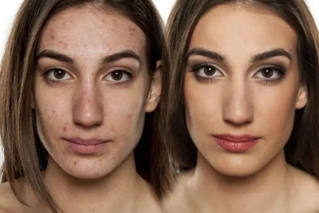 Masih Bingung Pilih BB Cream atau Foundation? Sekilas Terlihat Sama, Pahami Dulu Yuk Perbedaannya 7