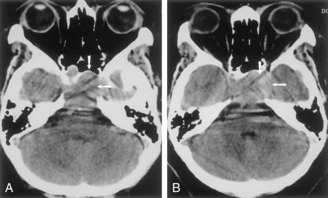 Hasilnya Sama-Sama Mirip Foto Klise hitam Putih, ini Bedanya X-Ray, CT Scan, dan MRI 9