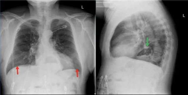 Hasilnya Sama-Sama Mirip Foto Klise hitam Putih, ini Bedanya X-Ray, CT Scan, dan MRI 7