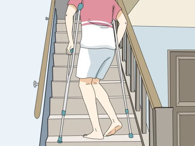 6 Panduan Memakai Tongkat Kruk yang Benar Saat Cedera Kaki. Jangan Asal Biar Cepat Pulih 11