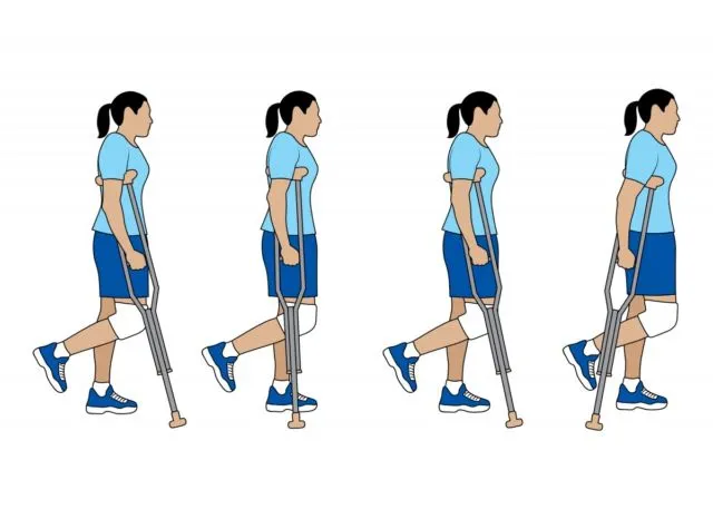 6 Panduan Memakai Tongkat Kruk yang Benar Saat Cedera Kaki. Jangan Asal Biar Cepat Pulih 10