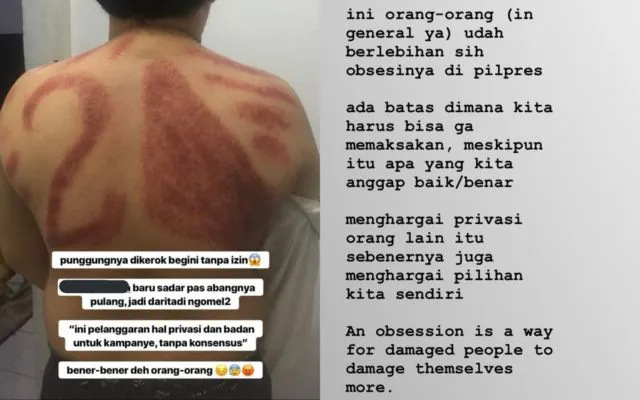 Dikerokin Tukang Urut, Punggung Pria ini Diarsir Nomor Urut Capres. Kocak, Dikira Baliho Kali~ 4
