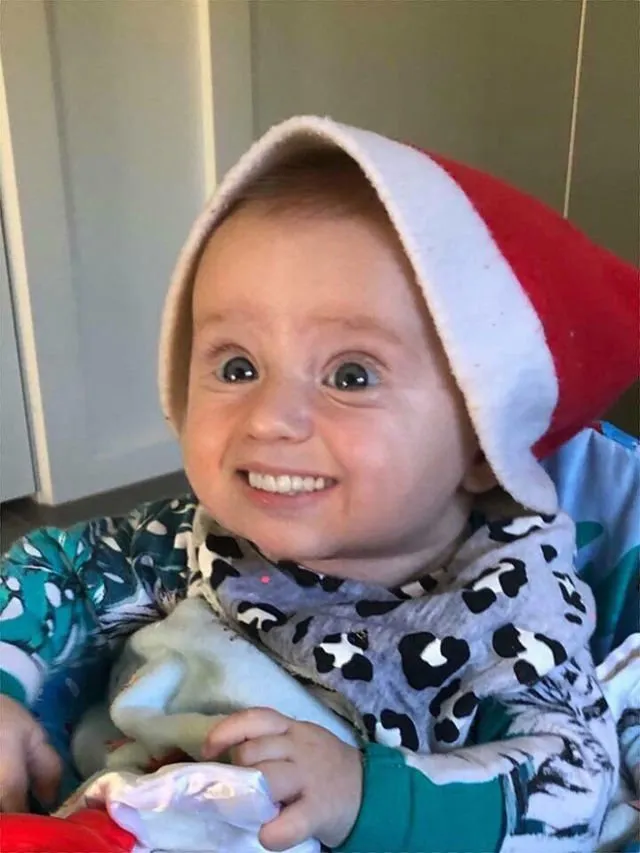 Kalau Bayi Udah Punya Gigi Sejak Lahir, Beginilah 11 Penampakannya. Bukannya Lucu, Malah Jadi Serem! 17