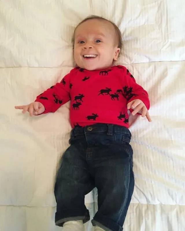 Kalau Bayi Udah Punya Gigi Sejak Lahir, Beginilah 11 Penampakannya. Bukannya Lucu, Malah Jadi Serem! 19