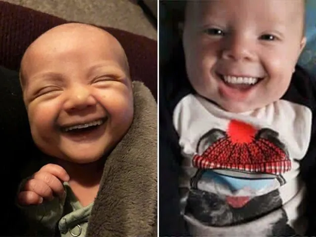 Kalau Bayi Udah Punya Gigi Sejak Lahir, Beginilah 11 Penampakannya. Bukannya Lucu, Malah Jadi Serem! 13