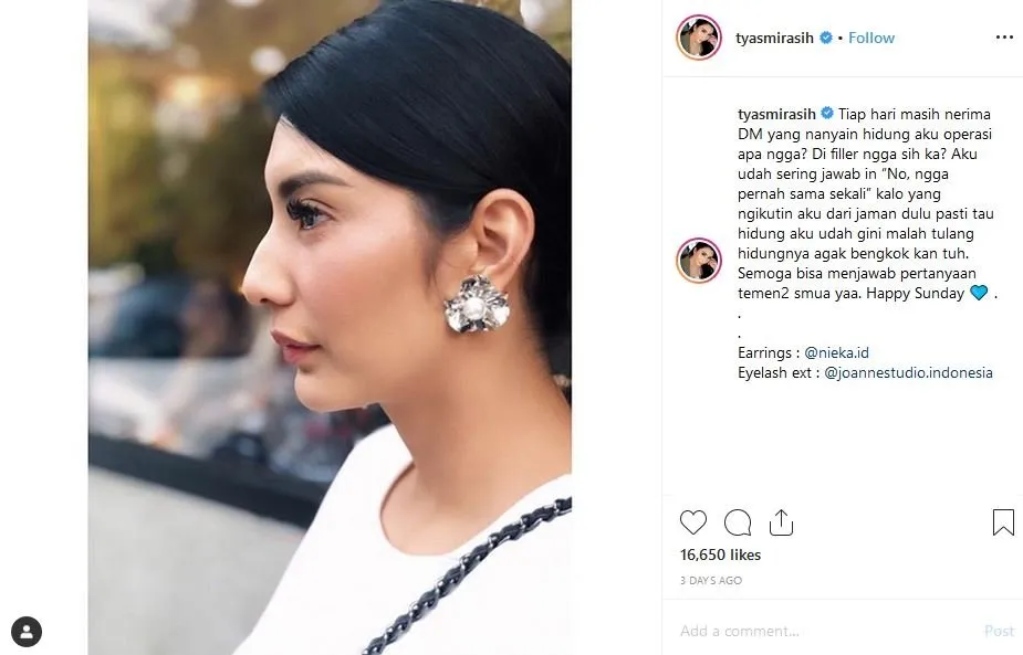 Jengah Dibilang Oplas, Tyas Mirasih Buktikan Kalau Hidung Mancungnya Asli. Cuma Satu Kok yang Berubah! 3