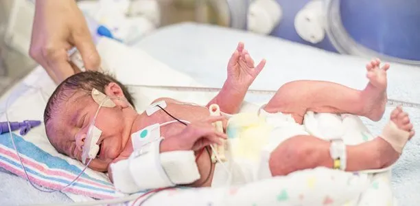 Sudden Infant Death Syndrome: Fenomena Bayi Tiba-tiba Meninggal, Posisi Tidur Jadi Penyebab juga lo 6