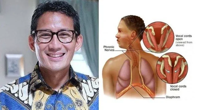 Sandiaga Uno Belakangan Jarang Muncul dan Terlihat Pucat, Seperti Apa Kondisi Kesehatannya? 4
